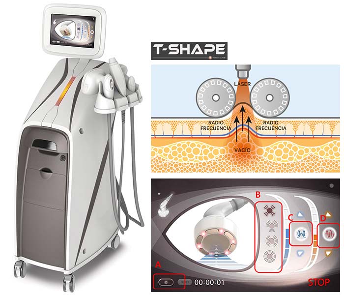 t-shape-montaje